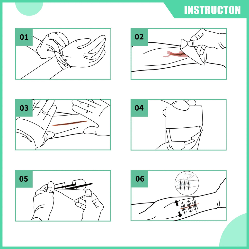 RHINO RESCUE Zip Stitch 6pcs with Wound Dresssings, Wound Closure Strips Without Suture, Zipstitch Laceration Closure Kit