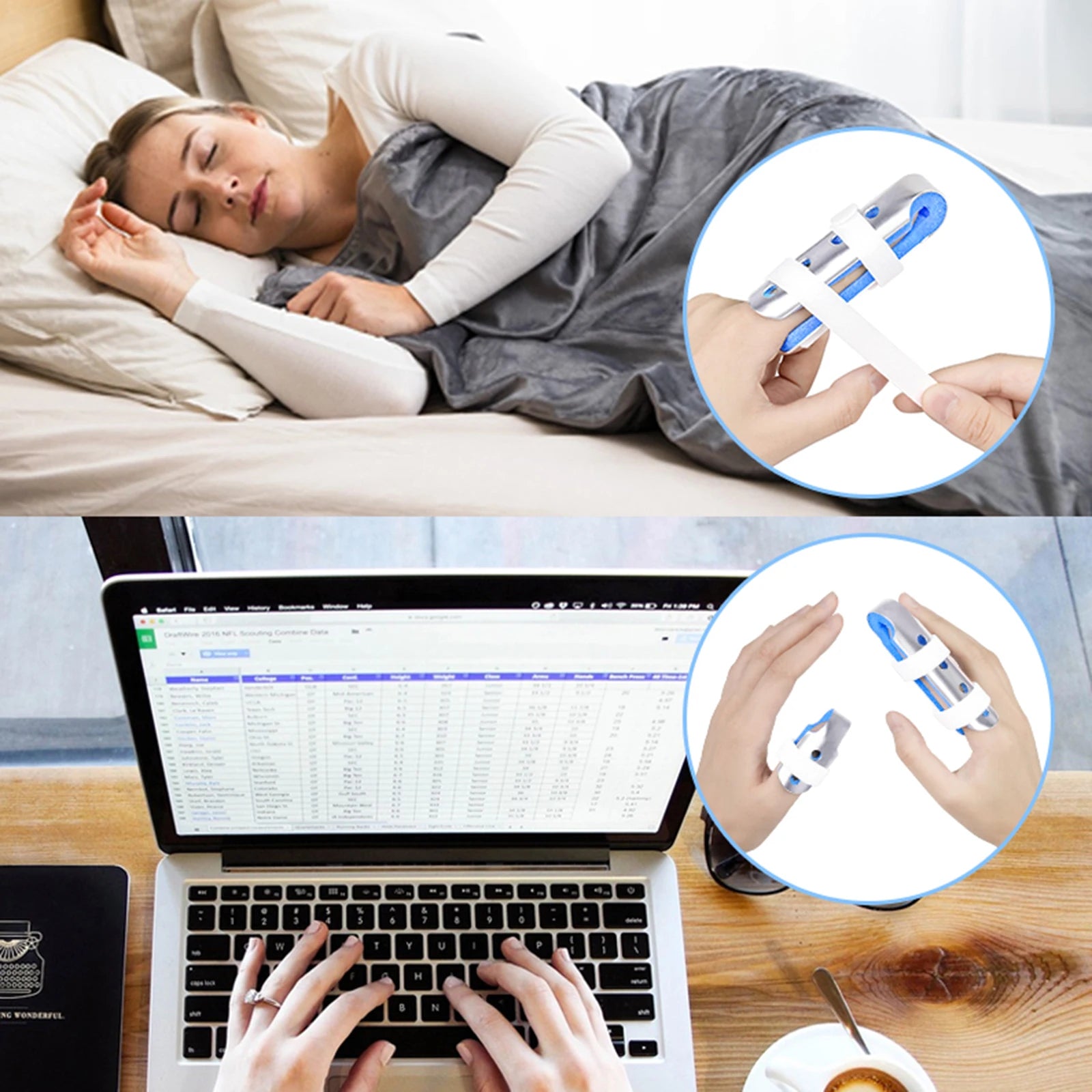 Rhino Rescue Finger Splint – 3PCS Adjustable Finger Brace for Broken Fingers & Joint Support (Blue)